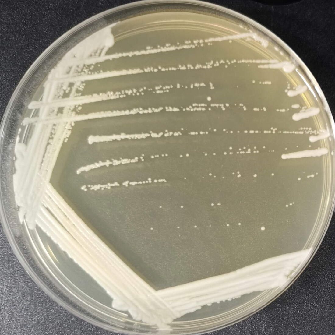 Jeding Seiberlindner's yeast-BNCC