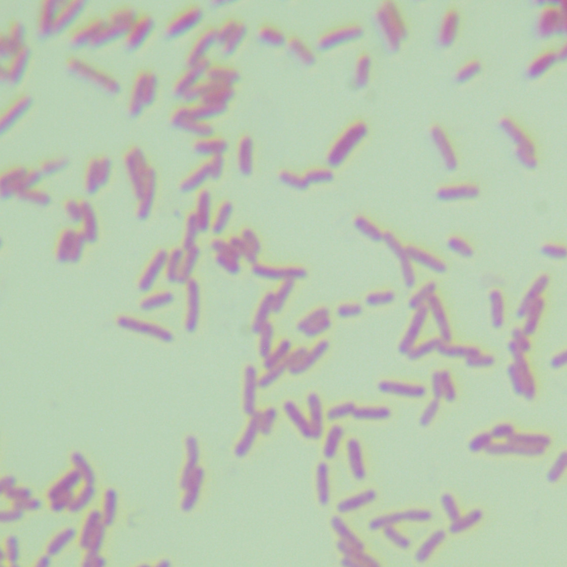 Escherichia coli-BNCC
