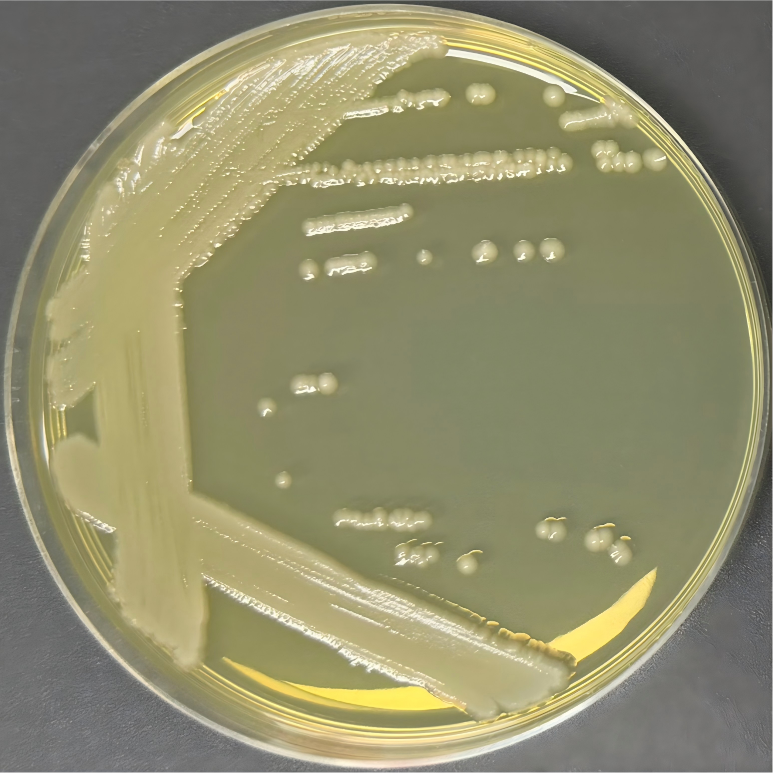 Klebsiella pneumoniae subsp. pneumoniae-BNCC