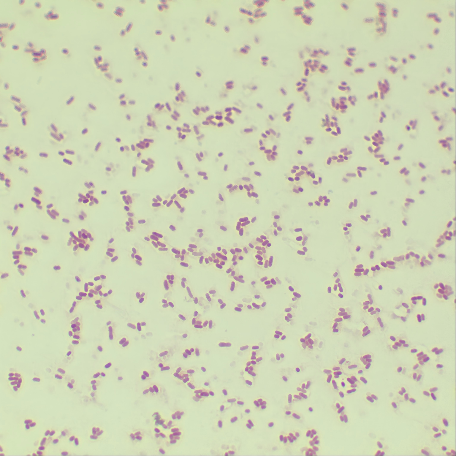 Klebsiella pneumoniae subsp. pneumoniae-BNCC