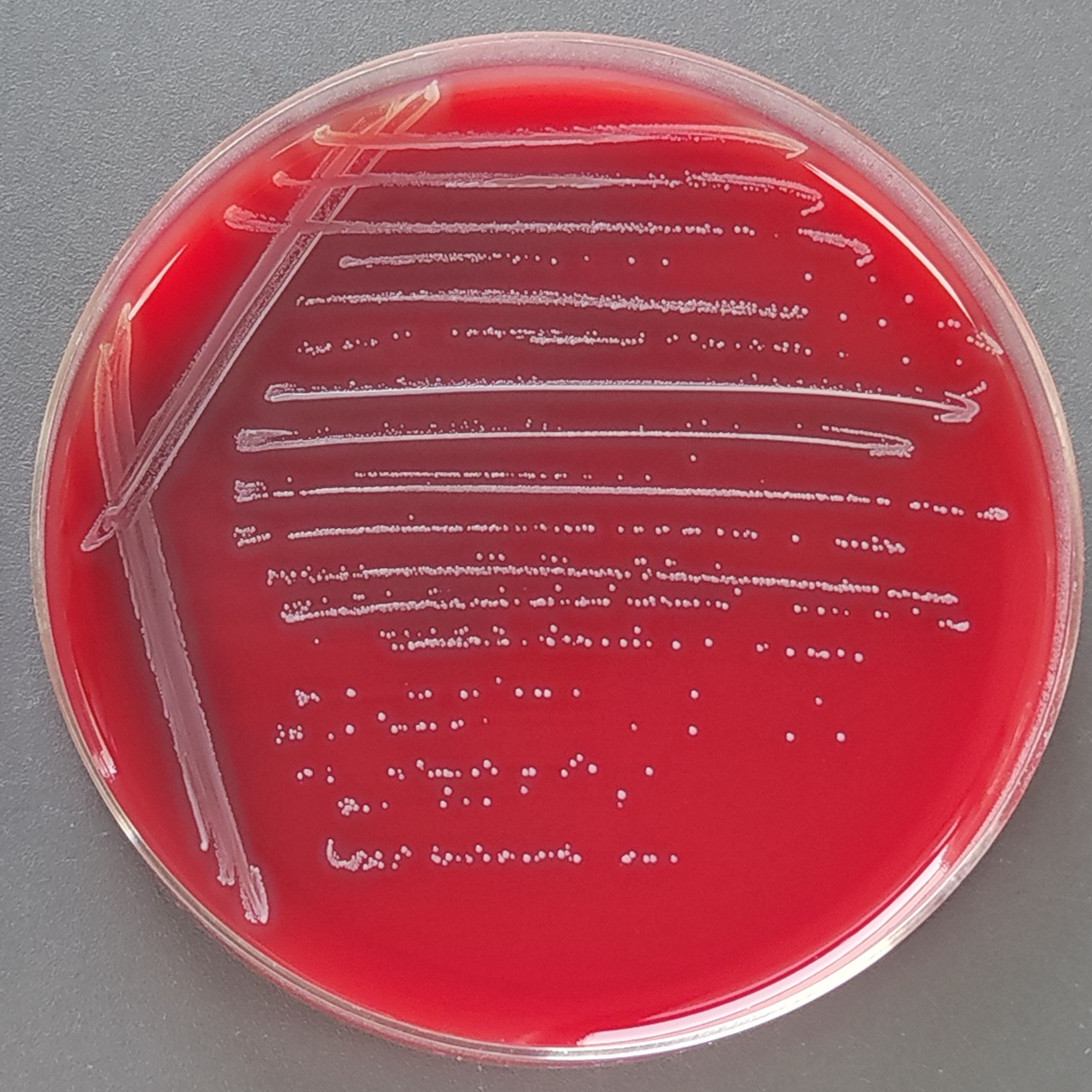 Streptococcus pyogenes-BNCC