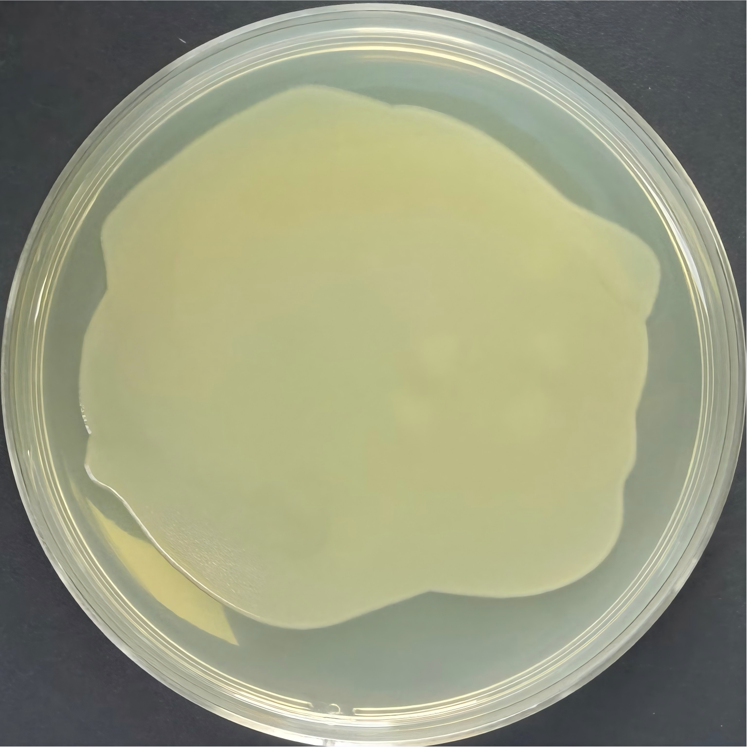 DH5 α (containing pet sumo plasmid) Escherichia coli-BNCC