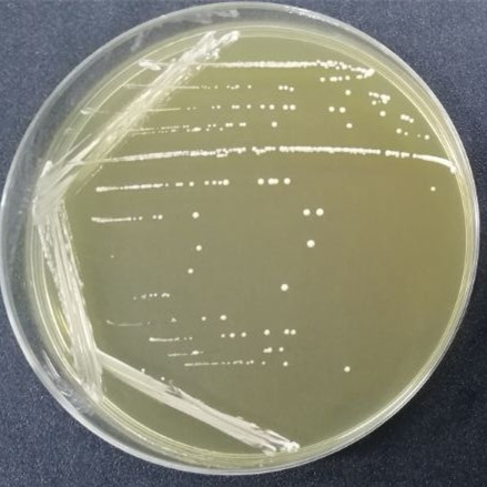 Lactobacillus plantarum subspecies-BNCC
