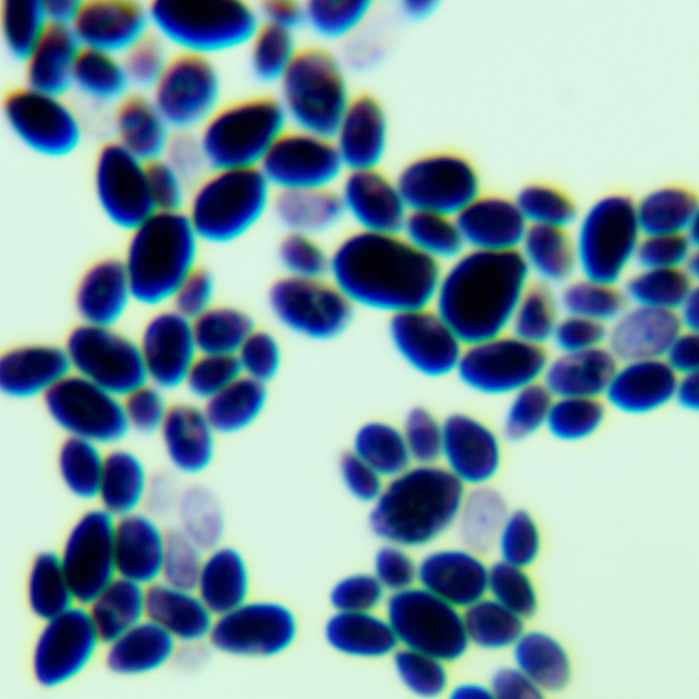 Candida albicans-BNCC