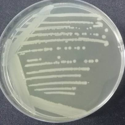 Shigella Songnei-BNCC