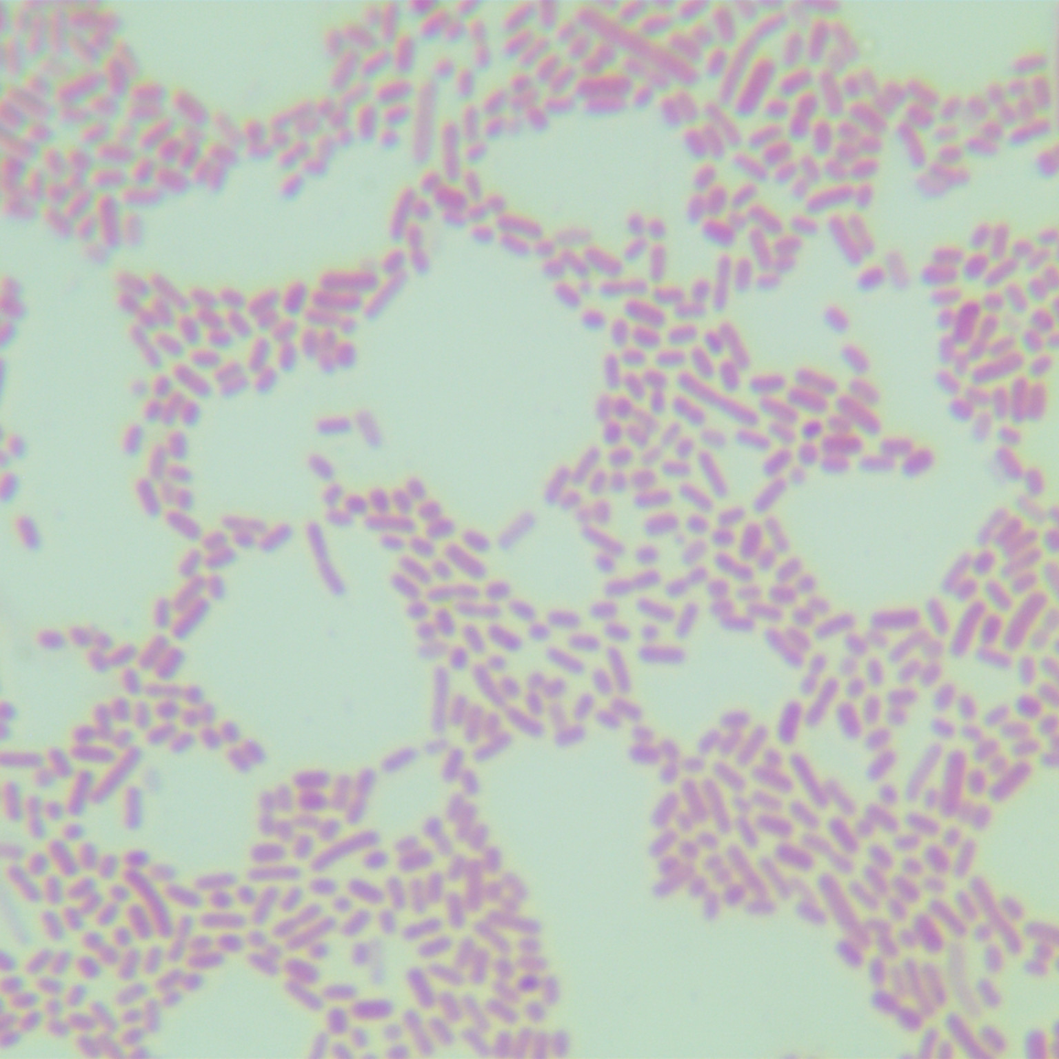 Shigella Songnei-BNCC