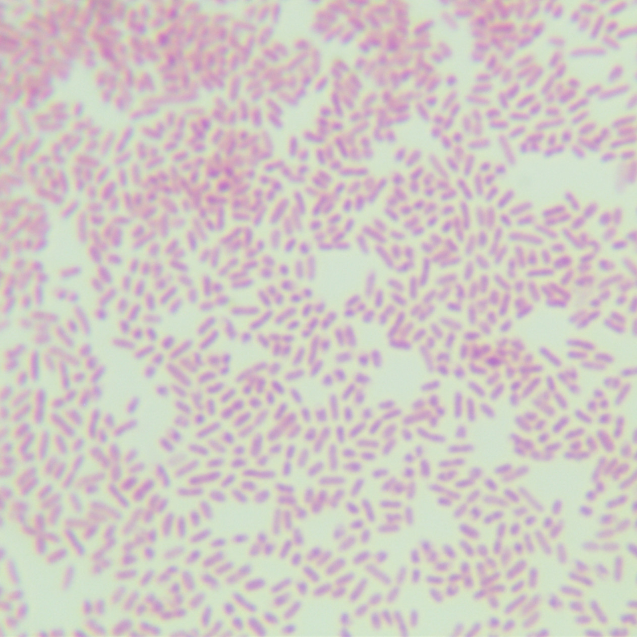 Burkholderia cepacia-BNCC