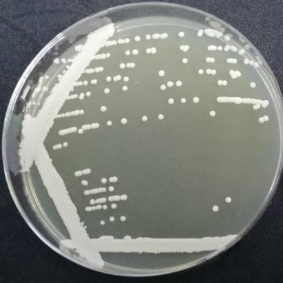Abnormal Pichia pastoris-BNCC