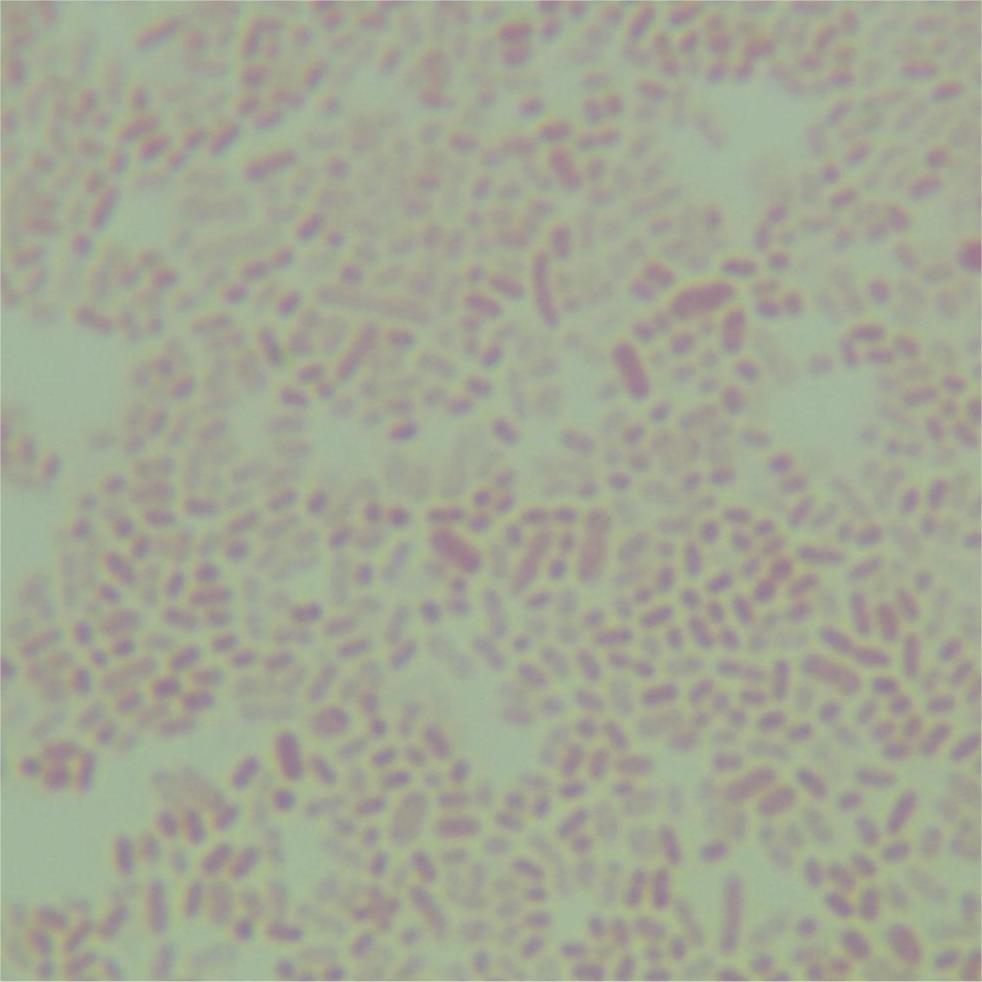 Enterobacter cloacae-BNCC