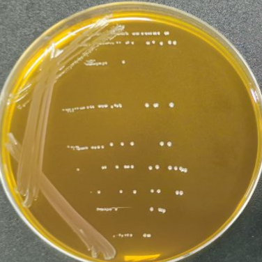 Lactobacillus acidophilus-BNCC