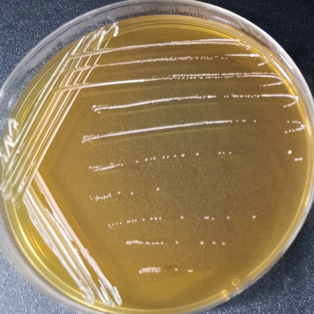 Lactobacillus plantarum-BNCC
