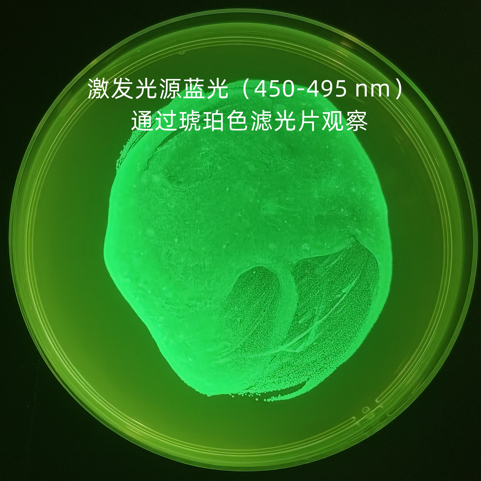 Shigella flexneri GFP-BNCC