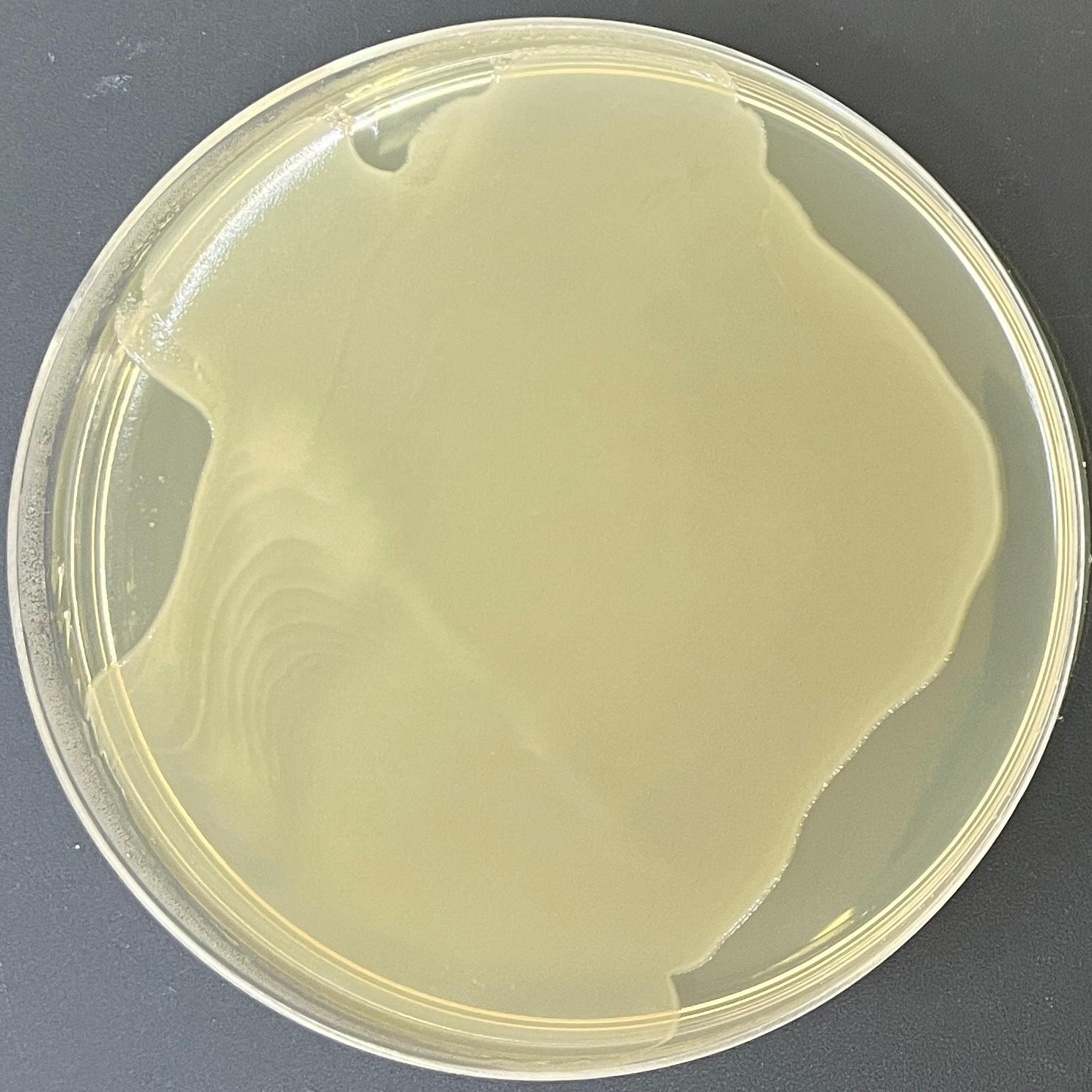 DH5 α (containing pcDNA Ikka HA WT plasmid) Escherichia coli-BNCC