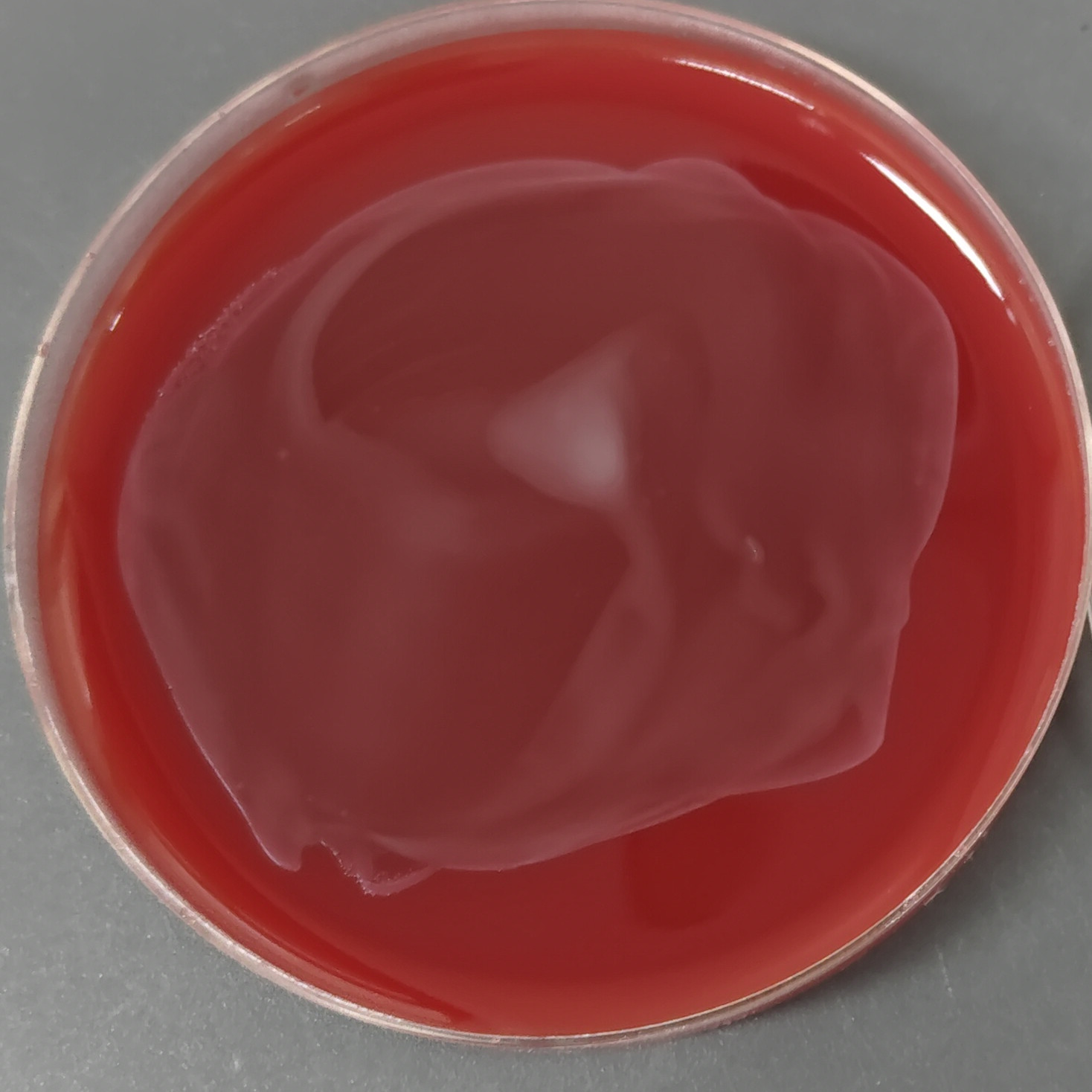 Clostridium difficile-BNCC