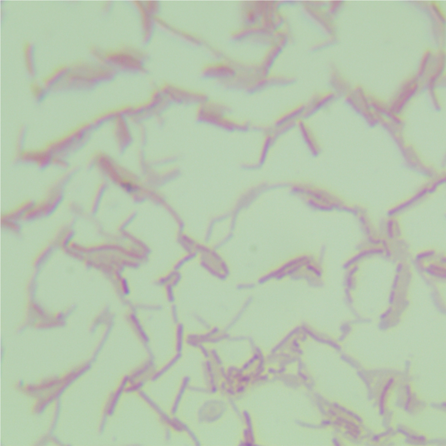Clostridium difficile-BNCC