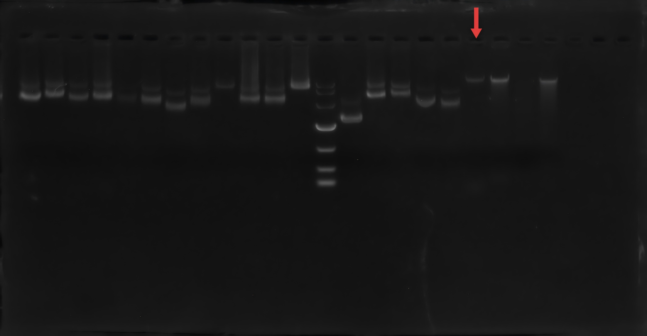 Cryptococcus vaginalis-BNCC