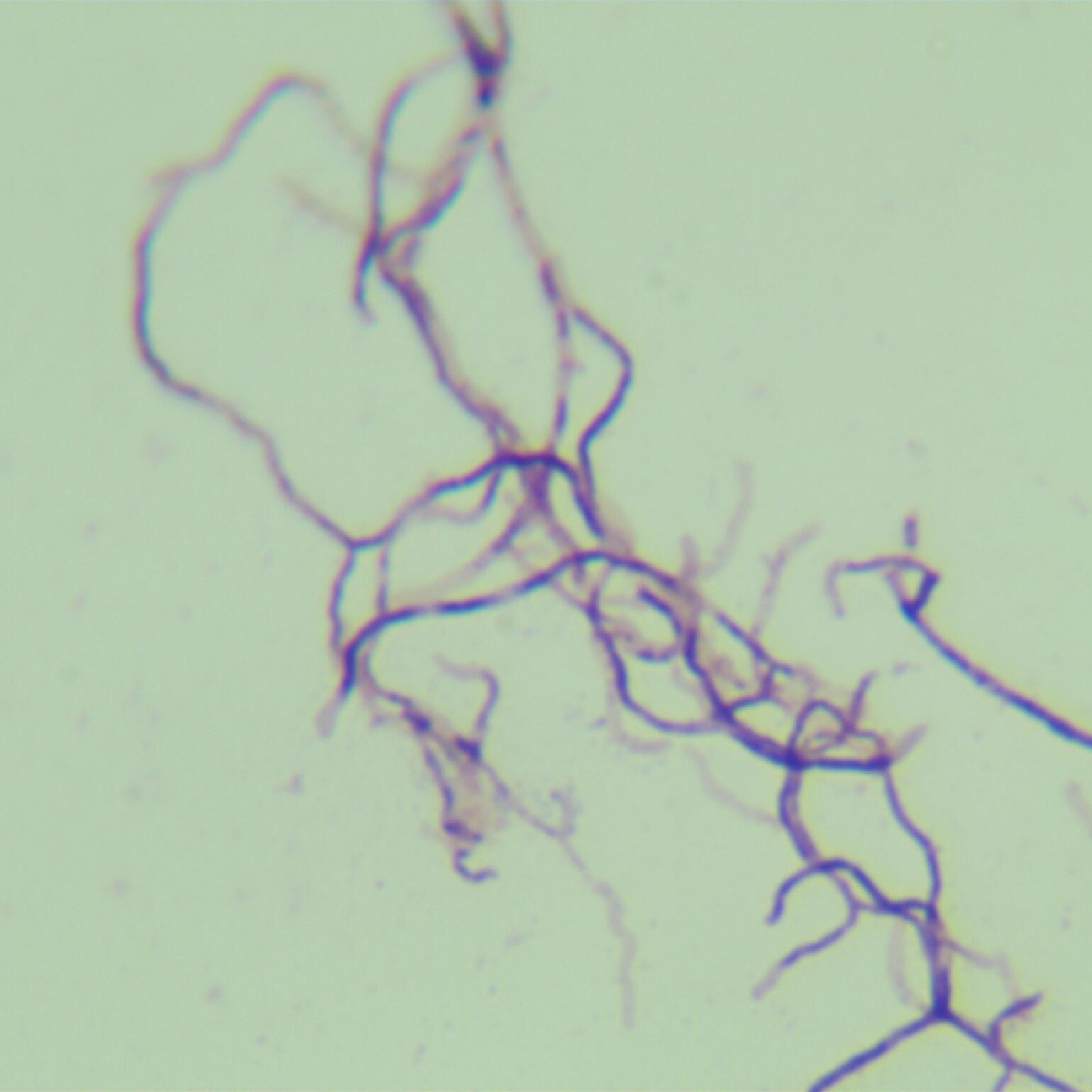 Cinnamon colored Klebsiella pneumoniae-BNCC