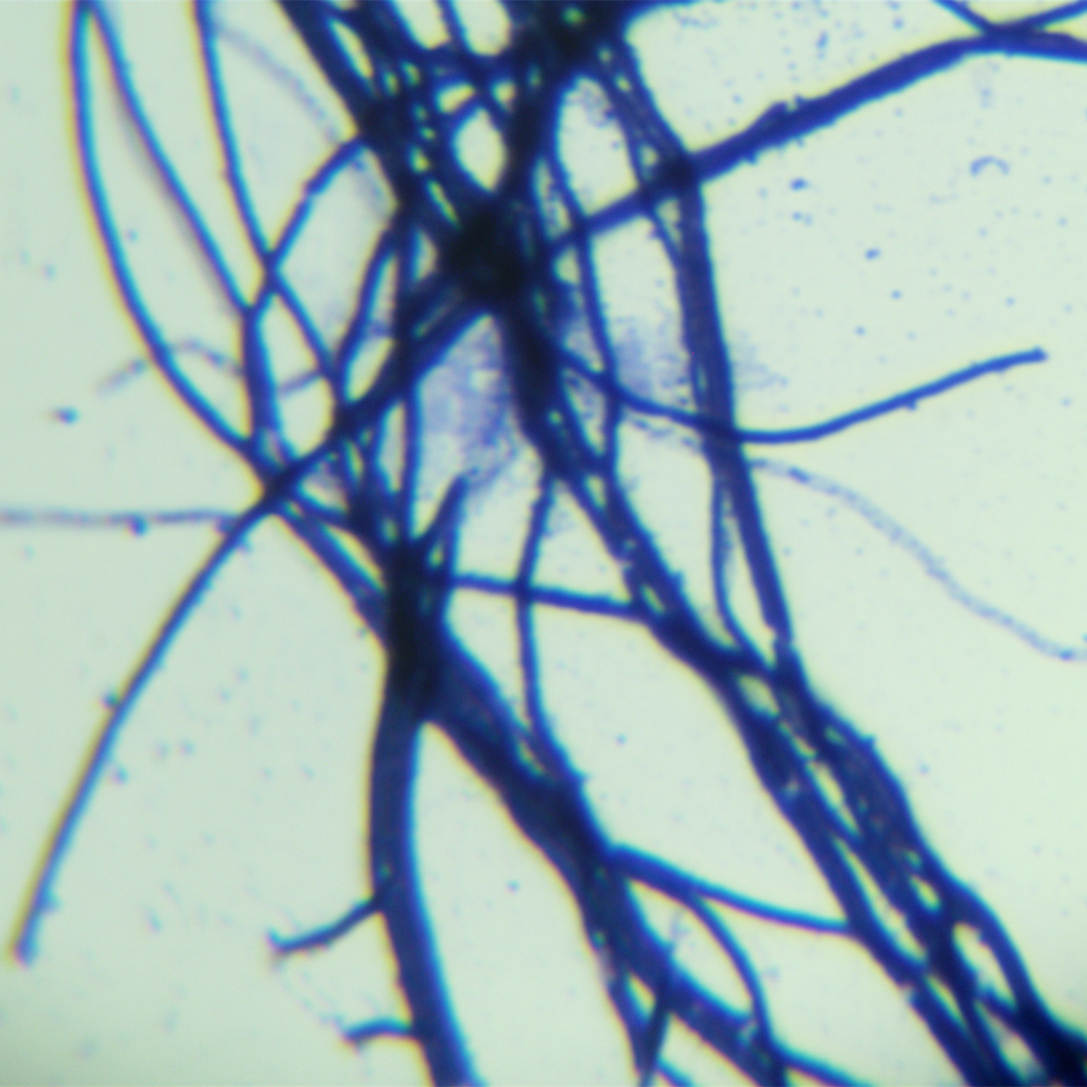 Lushan Streptomyces-BNCC