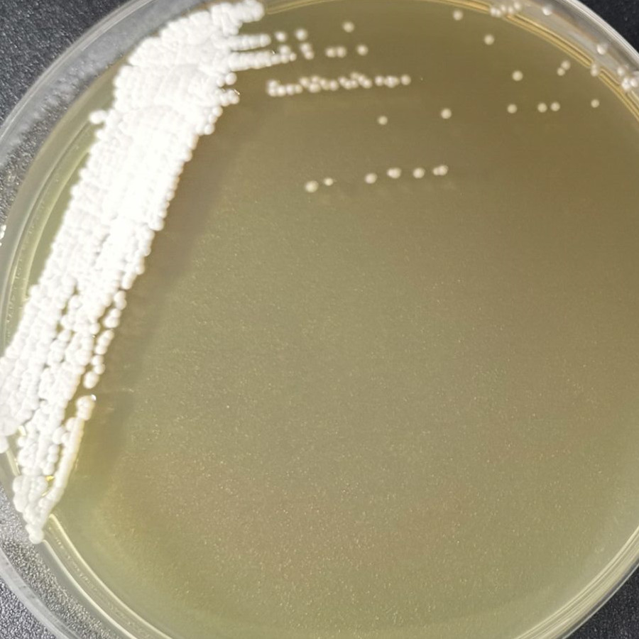 Streptomyces spinneretics-BNCC