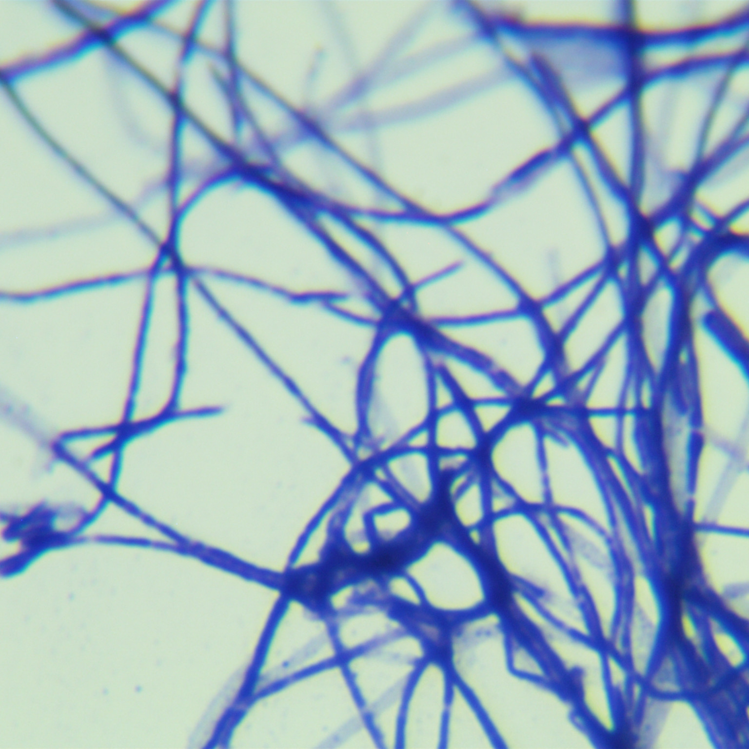 Streptomyces spinneretics-BNCC