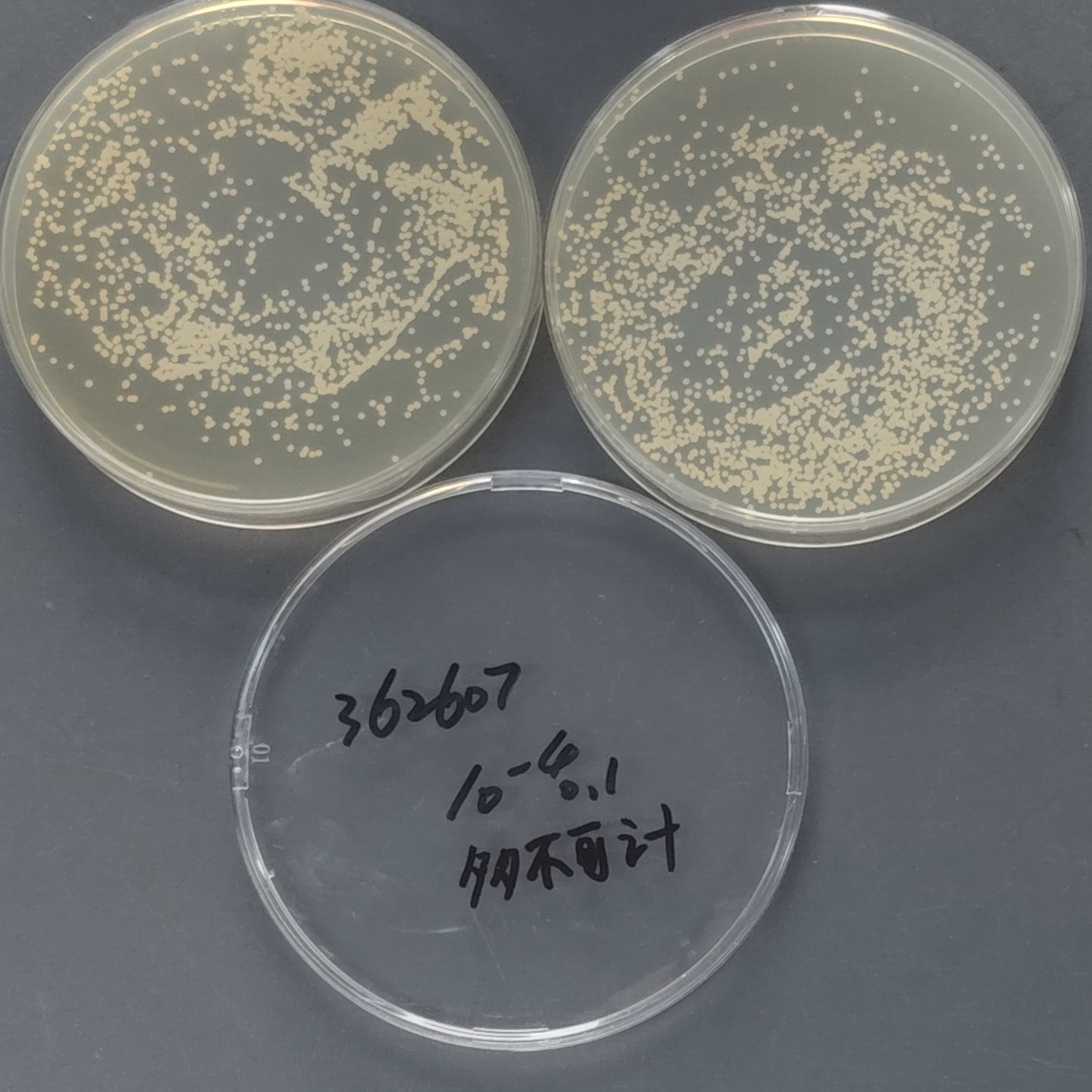 Cryptococcus neoformans-BNCC