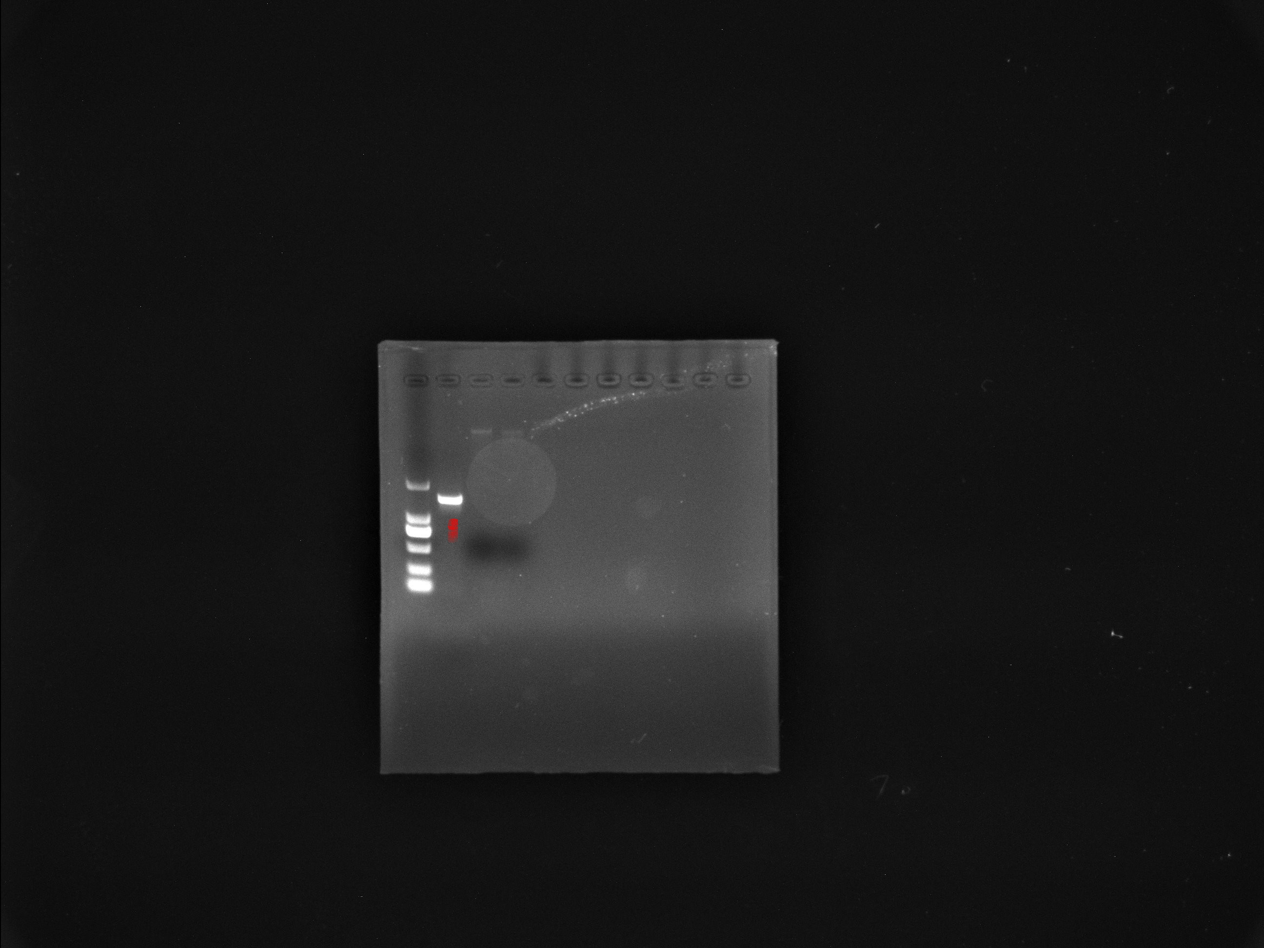 Etching Acinetobacter baumannii nucleic acid reference substance (Heat-inactivated) (strongly positive)-BNCC