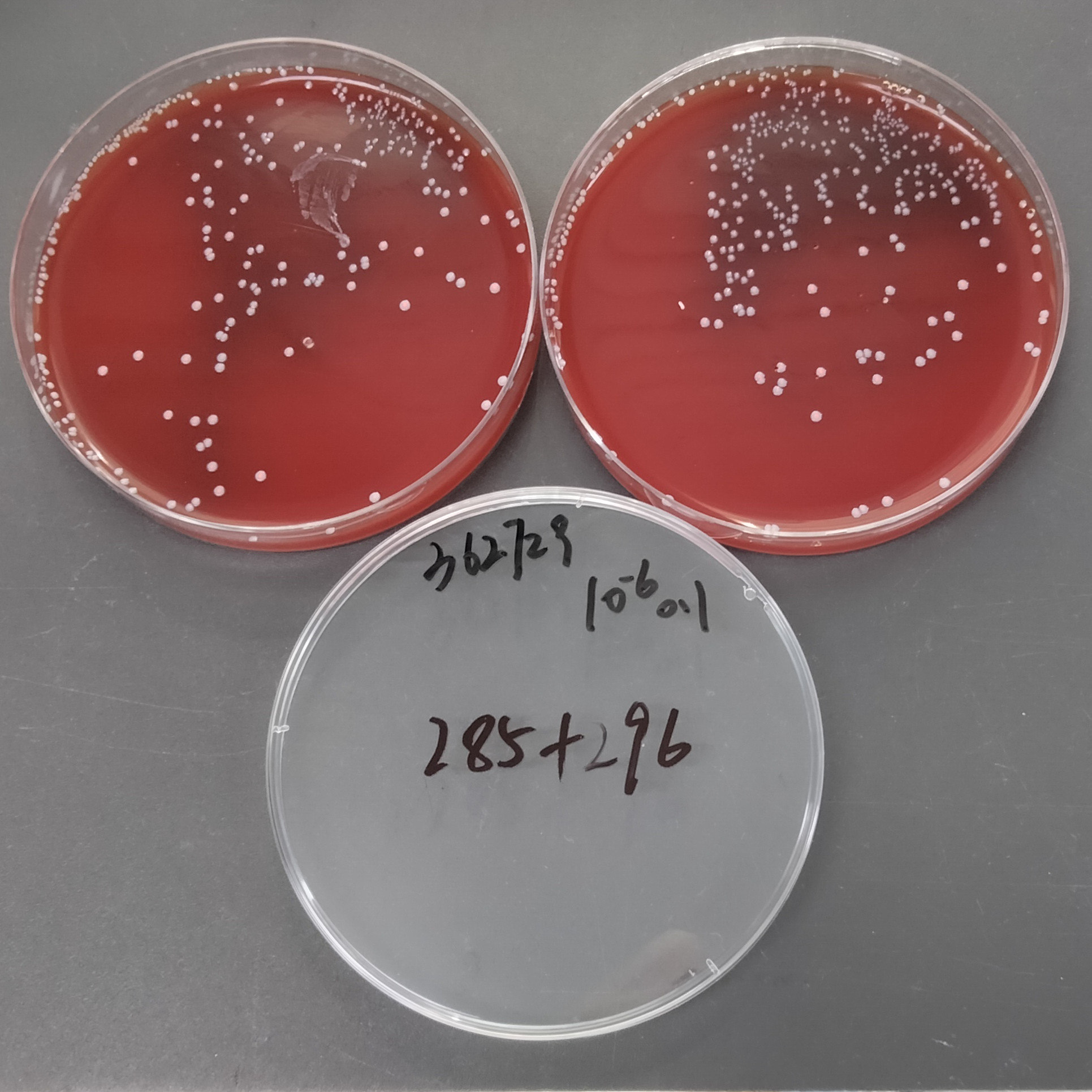 Streptococcus agalactiae-BNCC