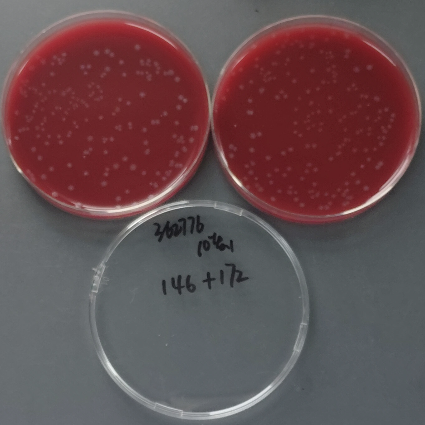 Clostridium difficile-BNCC