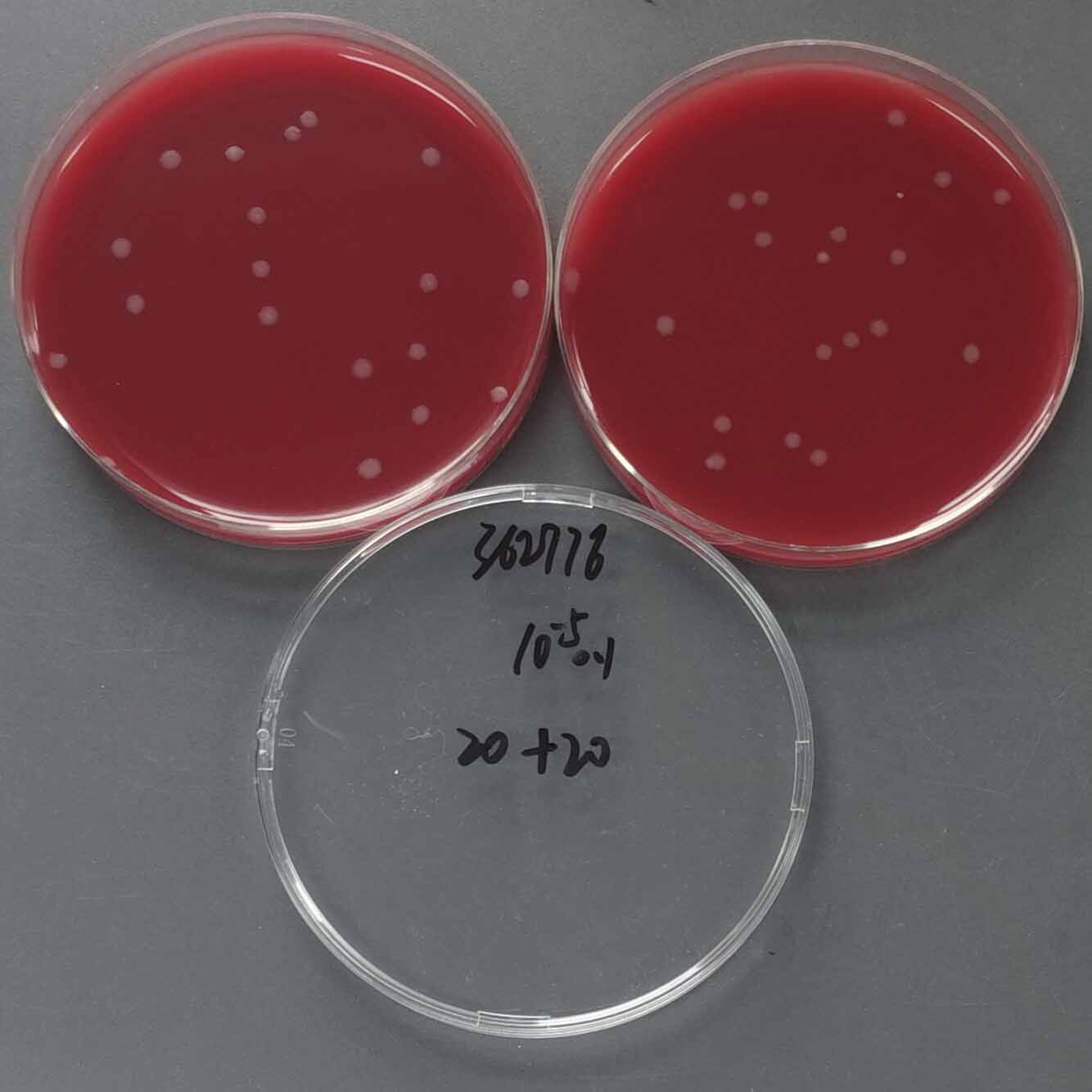 Clostridium difficile-BNCC