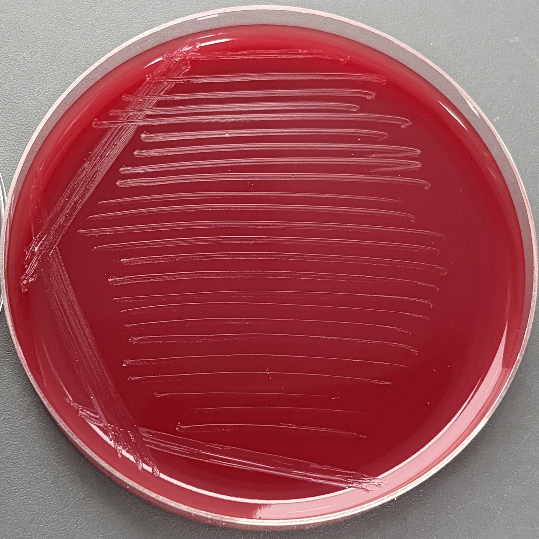 Alistipes sp. Marseille-P2431-BNCC