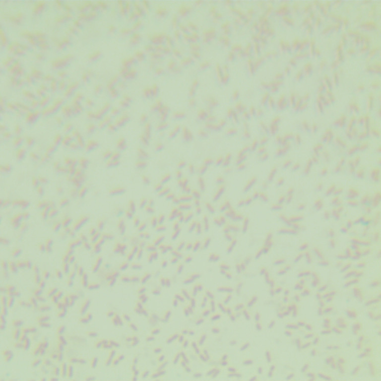 Alistipes sp. Marseille-P2431-BNCC