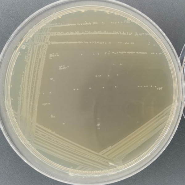 Trichomonas enterica-BNCC