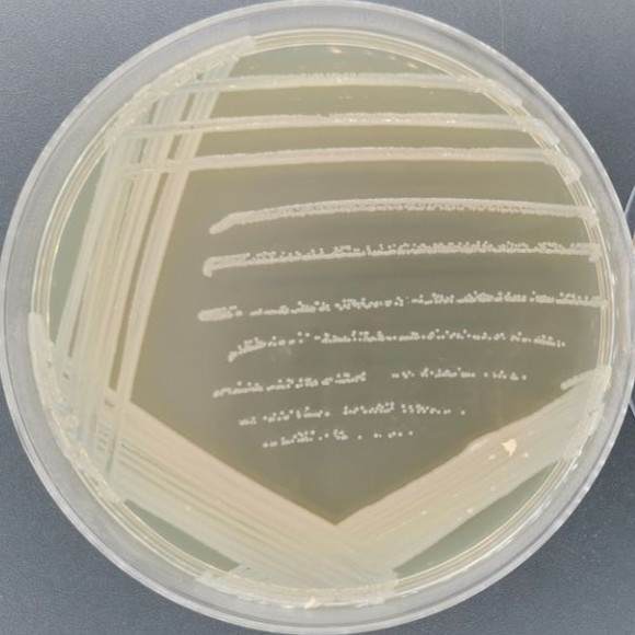 Pseudomonas aeruginosa-BNCC