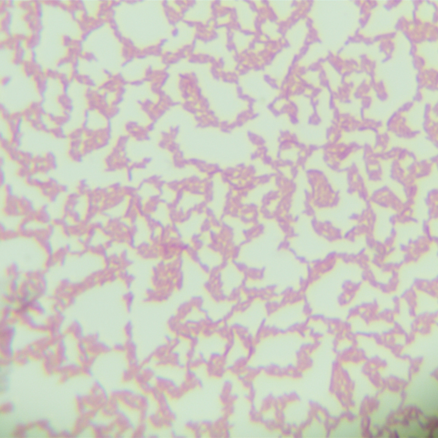 Pseudomonas aeruginosa-BNCC