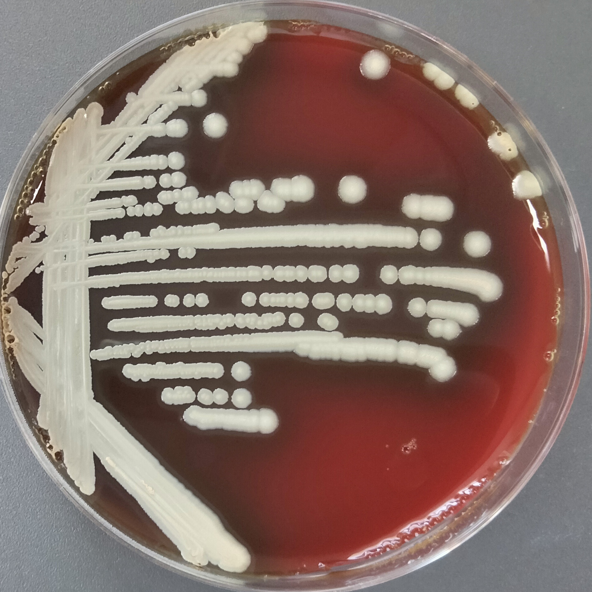 Oklahoma Burkholderia-BNCC
