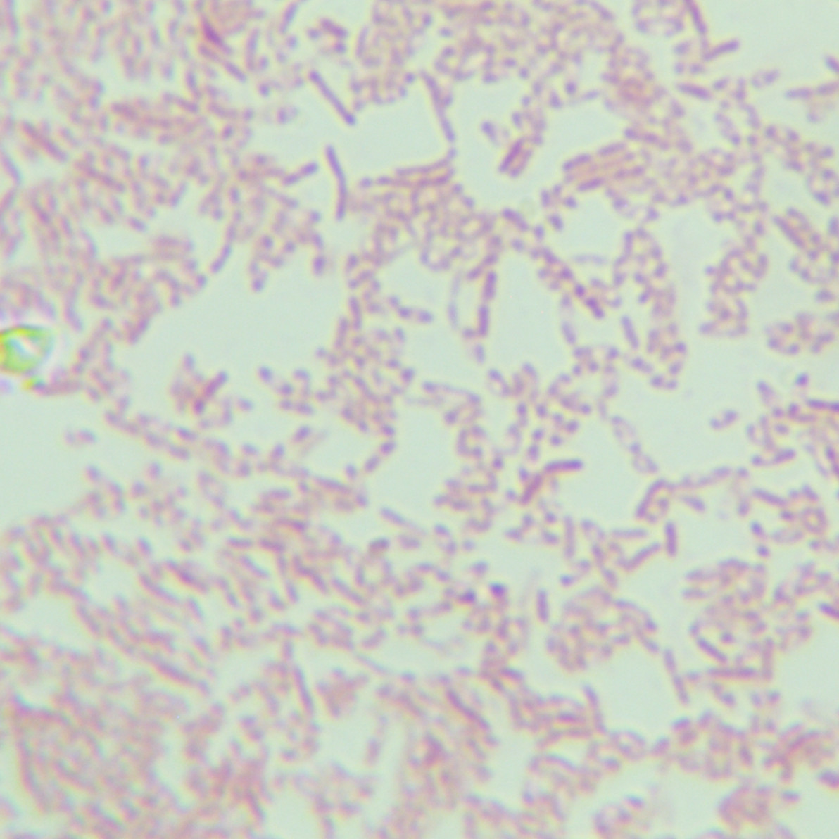 Oklahoma Burkholderia-BNCC