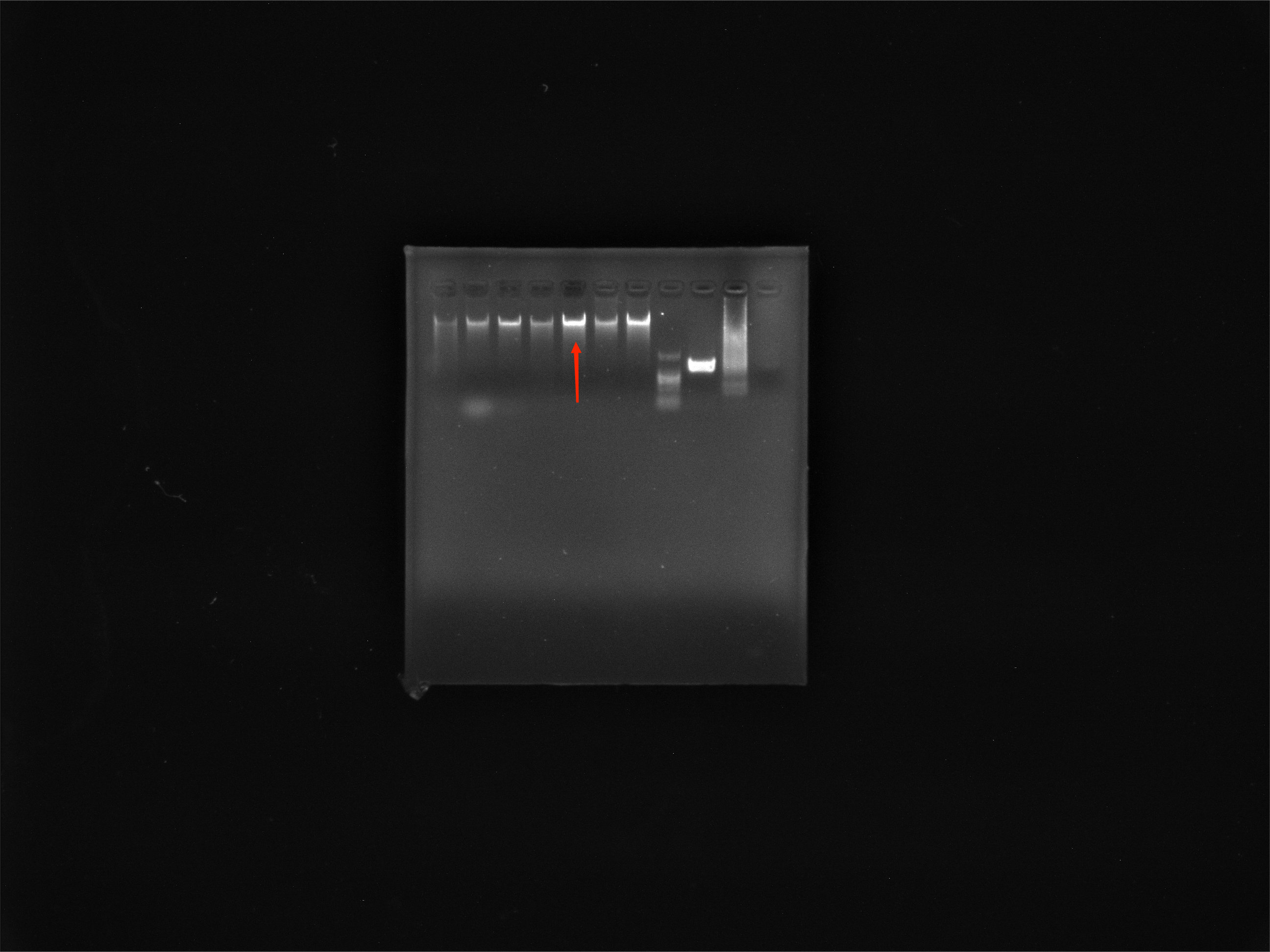 Acinetobacter baumannii-BNCC