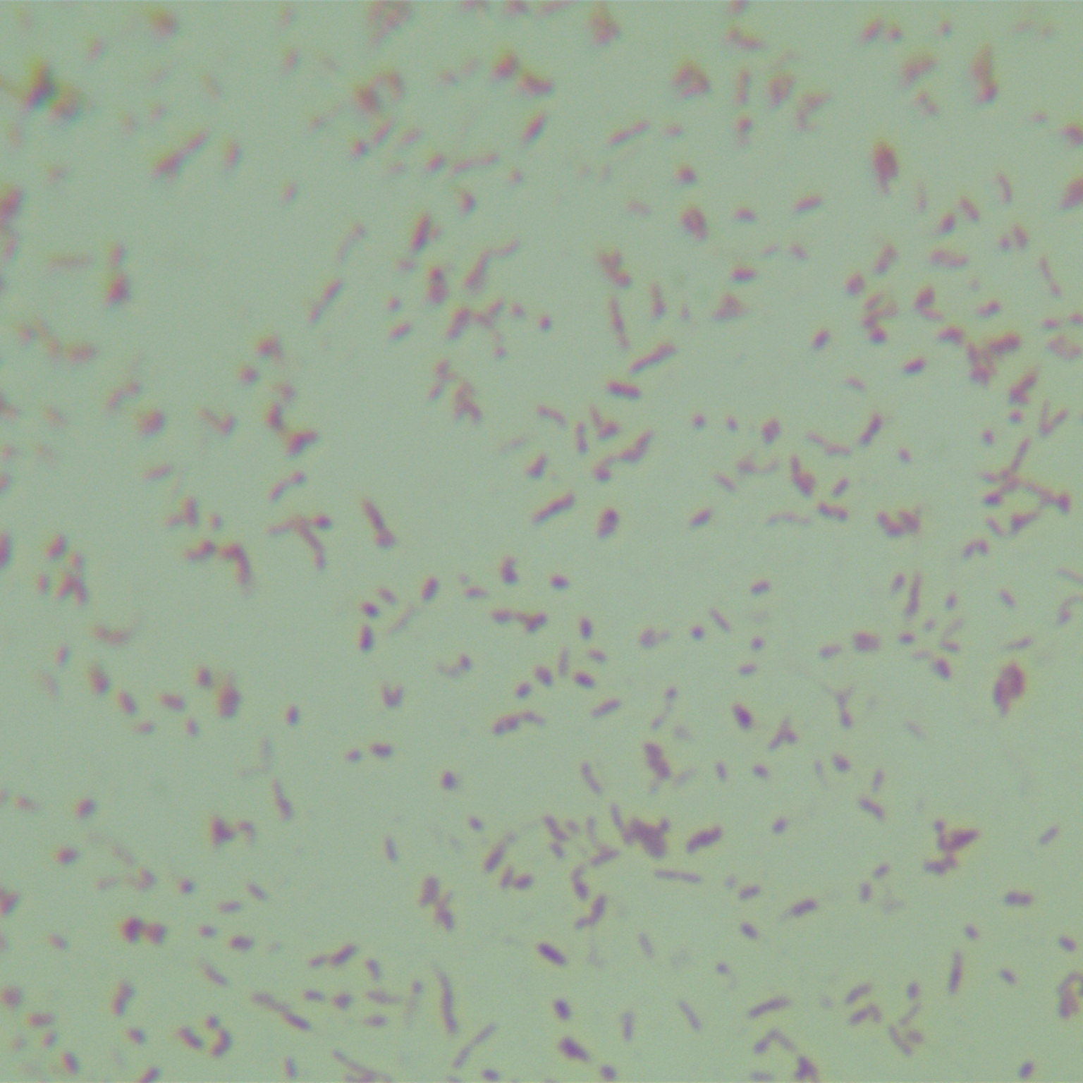 Odorous Butyricimonas-BNCC