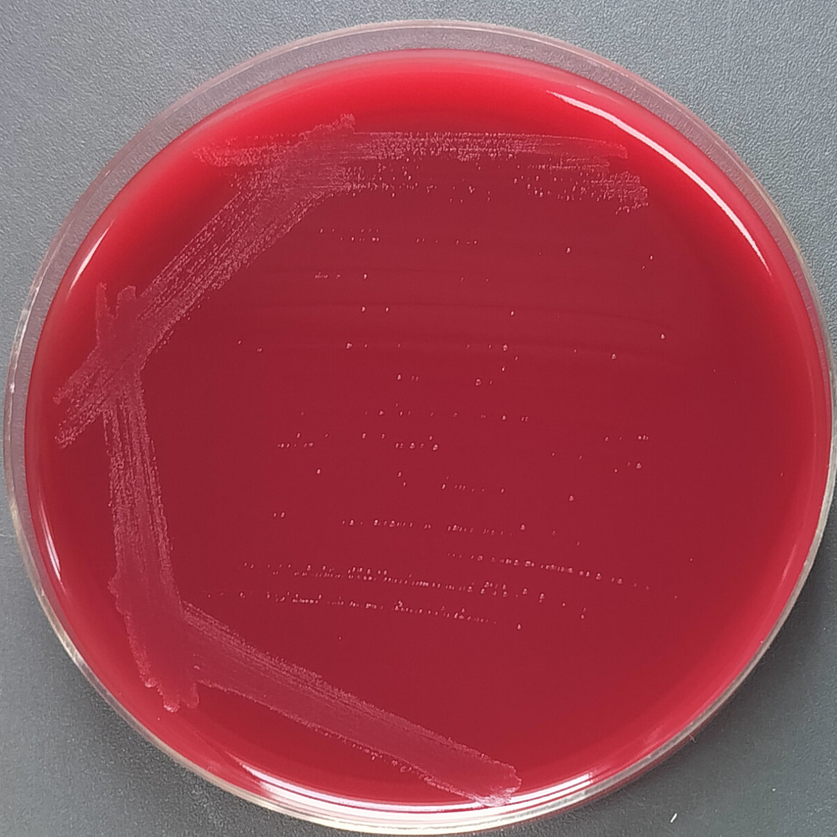 Escherichia coli-BNCC