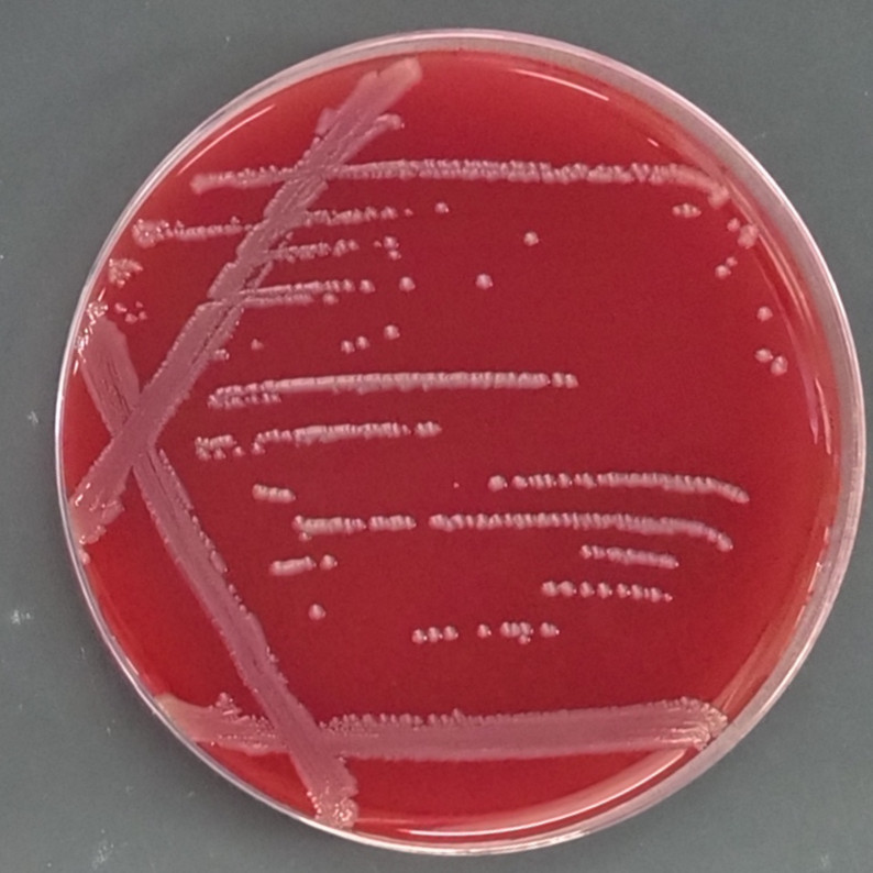 Duck type chicken bacillus-BNCC