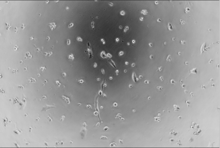Vesicular stomatitis virus-BNCC