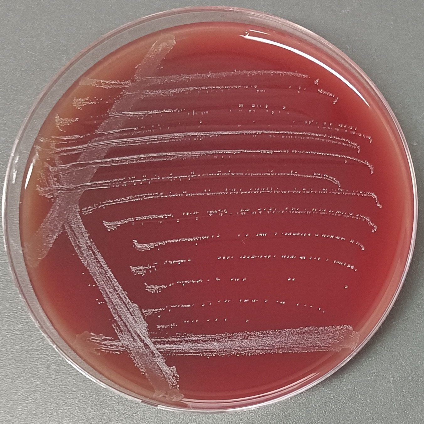 Streptococcus thermophilus-BNCC