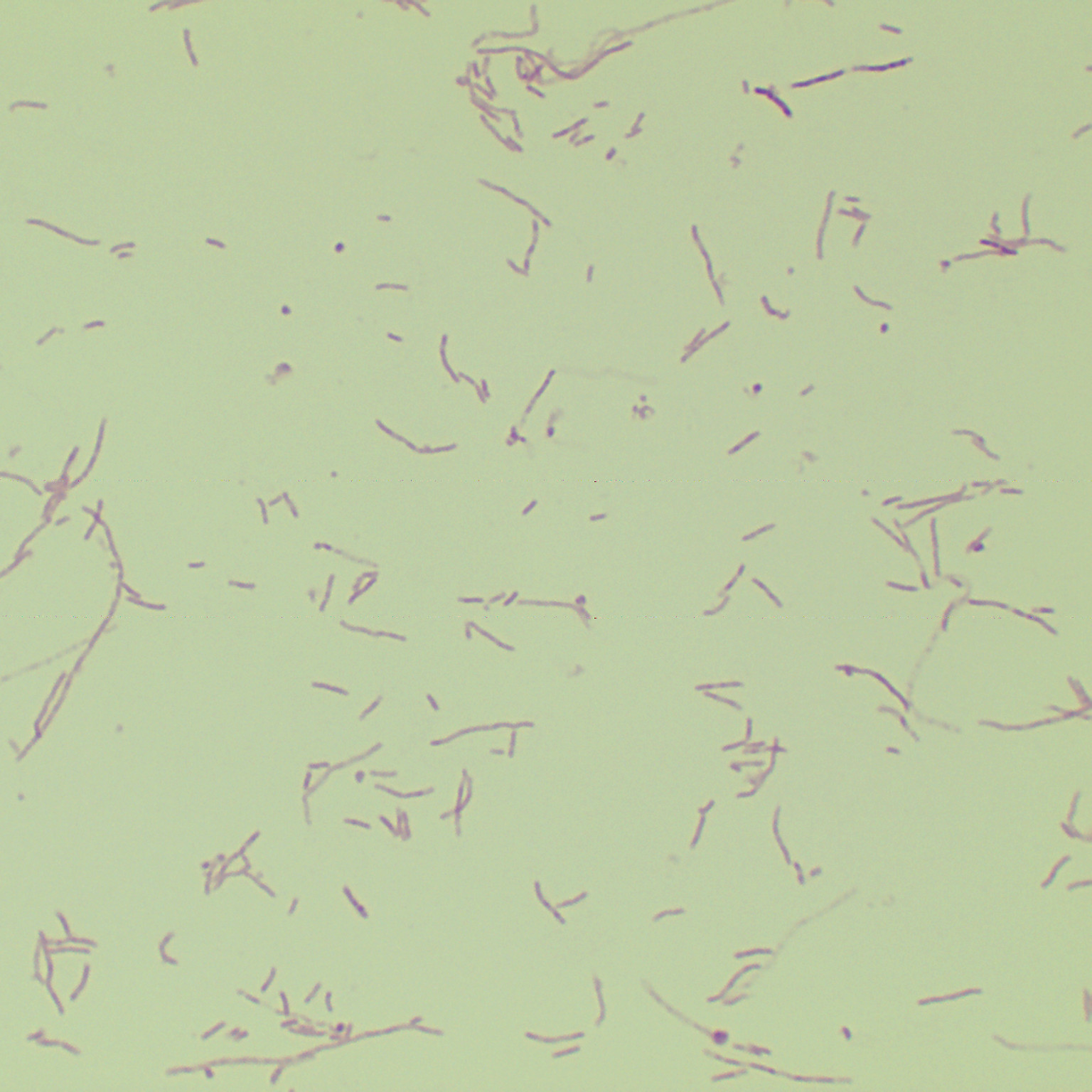Pseudomonas aeruginosa-BNCC