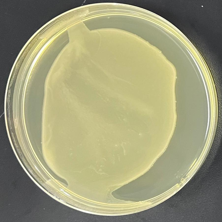 DH5 α (containing pCDNA3.1-ERBB2 (human) -9-3 × Linker EGFP plasmid) Escherichia coli-BNCC