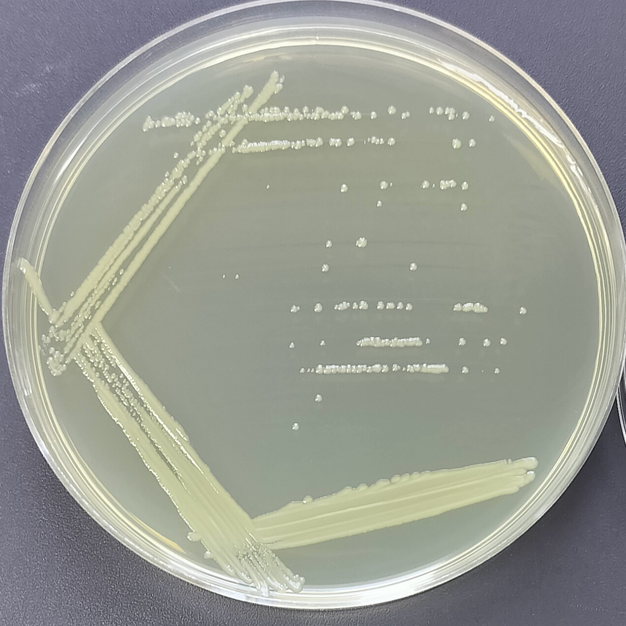 Green fluorescent labeling of Escherichia coli-BNCC