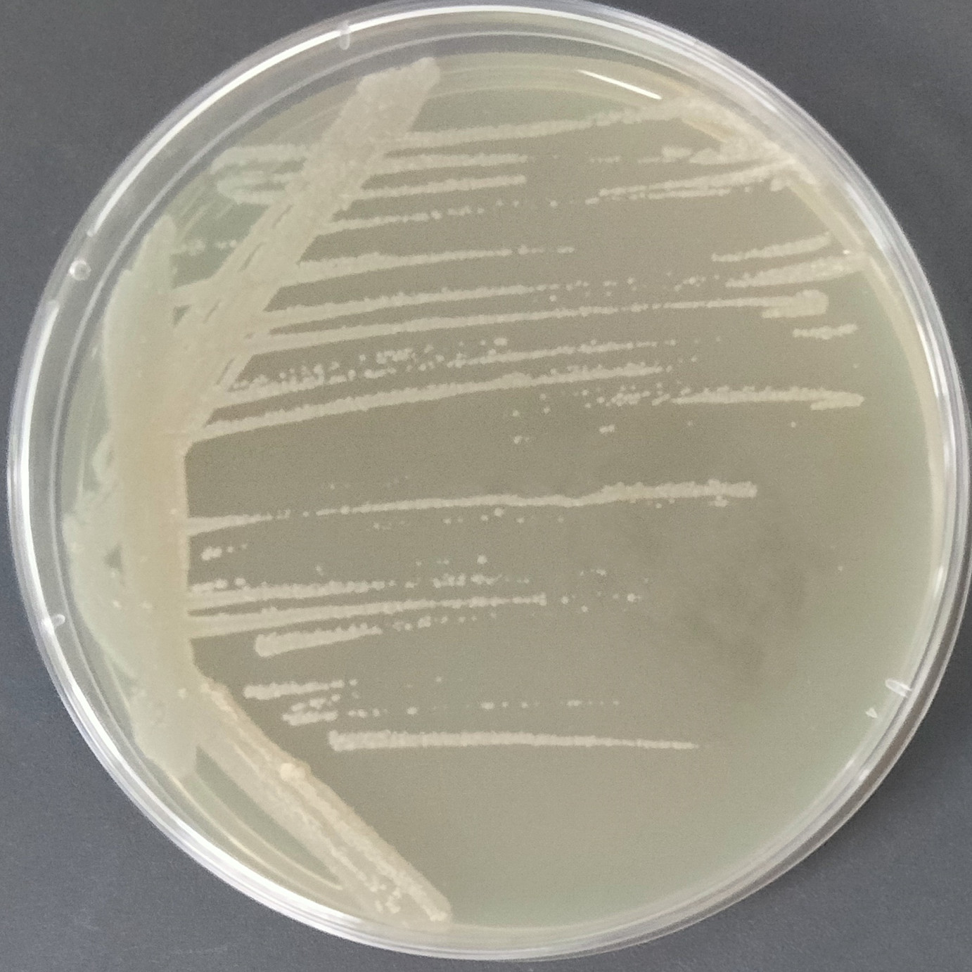 Giant subspecies of desert fungus-BNCC