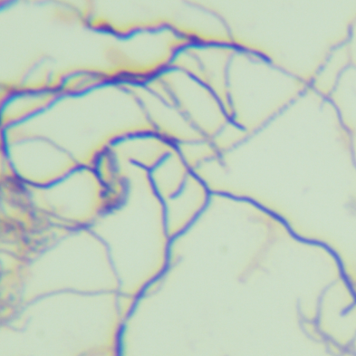 Aspergillus niger-BNCC