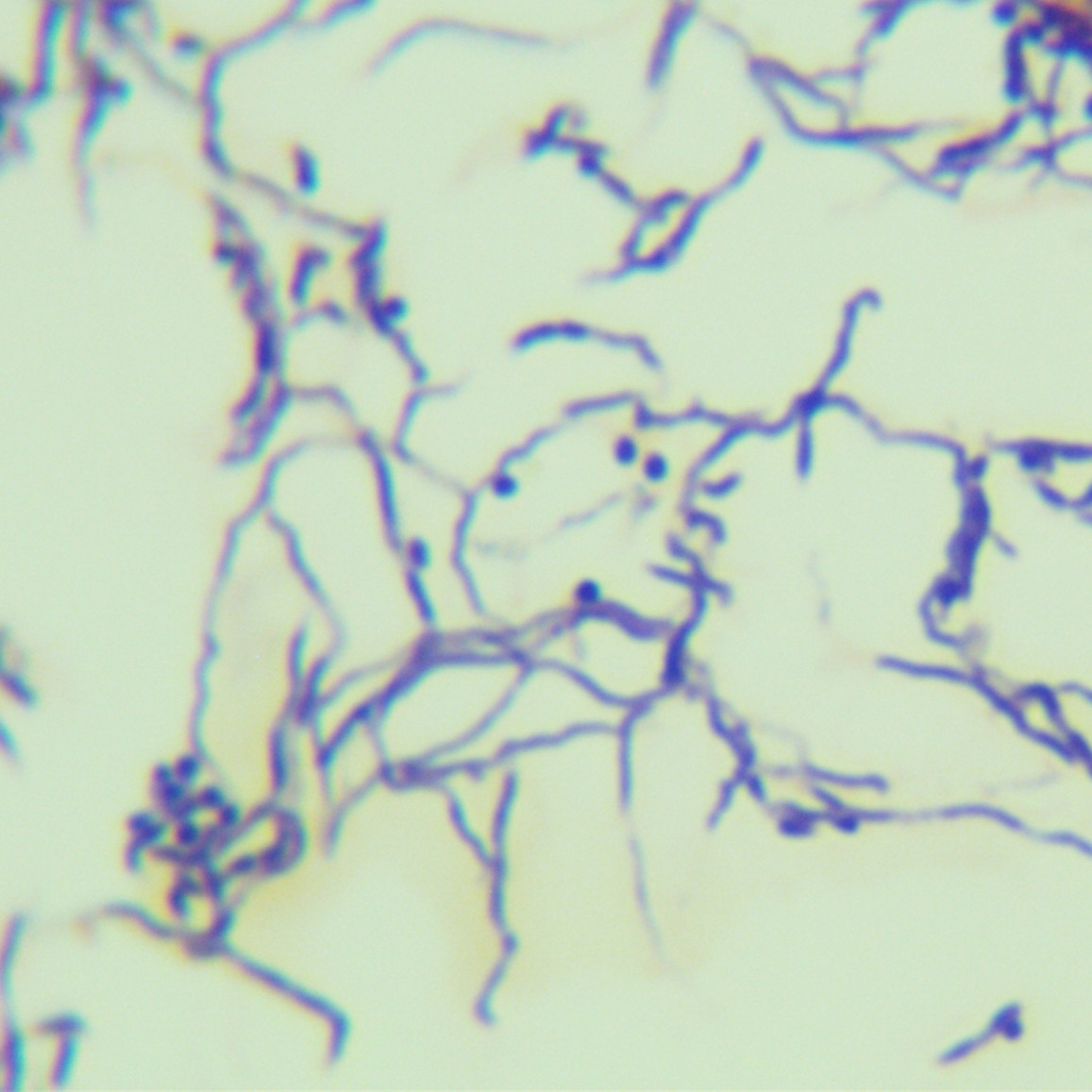 Brown red Pseudomonas aeruginosa-BNCC