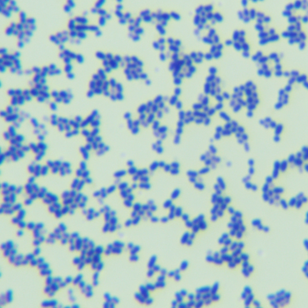 Quantitative strain of Streptococcus agalactiae-BNCC