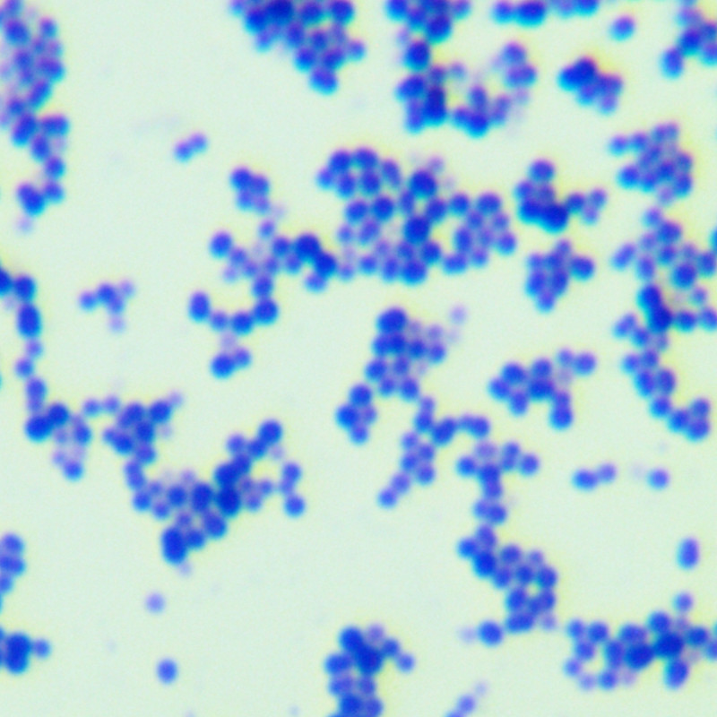 Quantitative strain of Streptococcus agalactiae-BNCC